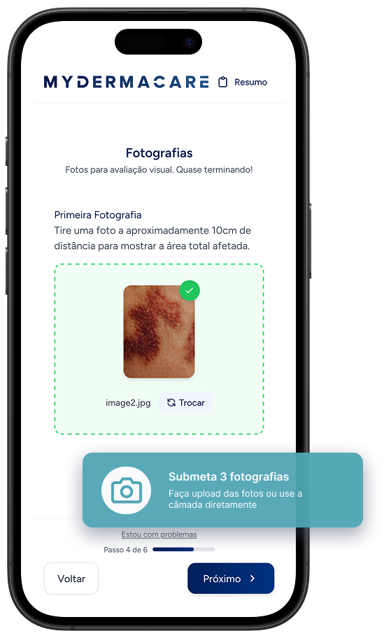 Upload de imagens na app MyDermaCare